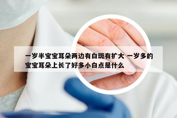 一岁半宝宝耳朵两边有白斑有扩大 一岁多的宝宝耳朵上长了好多小白点是什么