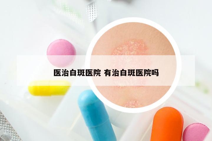 医治白斑医院 有治白斑医院吗