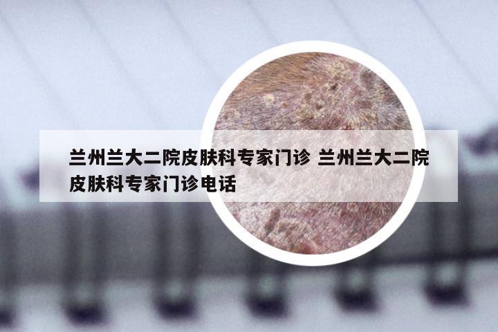 兰州兰大二院皮肤科专家门诊 兰州兰大二院皮肤科专家门诊电话