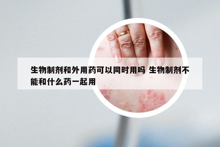 生物制剂和外用药可以同时用吗 生物制剂不能和什么药一起用