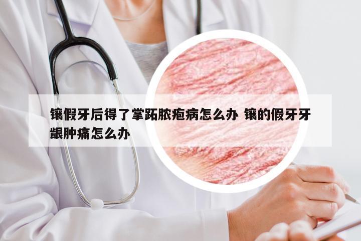 镶假牙后得了掌跖脓疱病怎么办 镶的假牙牙龈肿痛怎么办
