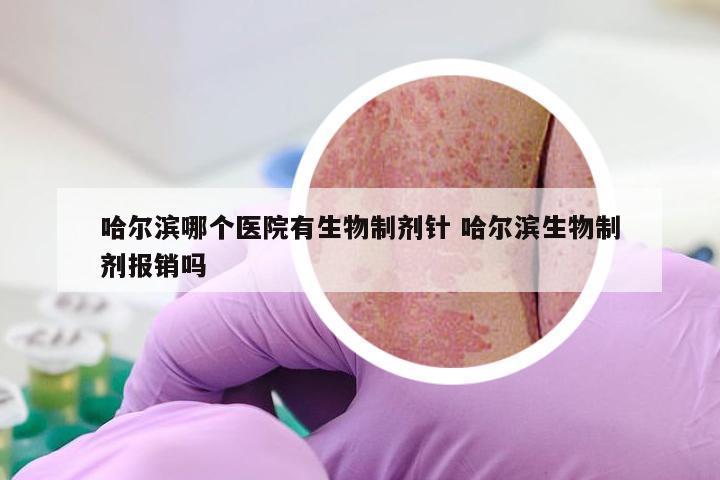 哈尔滨哪个医院有生物制剂针 哈尔滨生物制剂报销吗