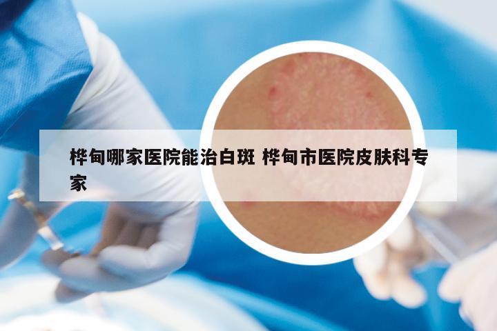 桦甸哪家医院能治白斑 桦甸市医院皮肤科专家