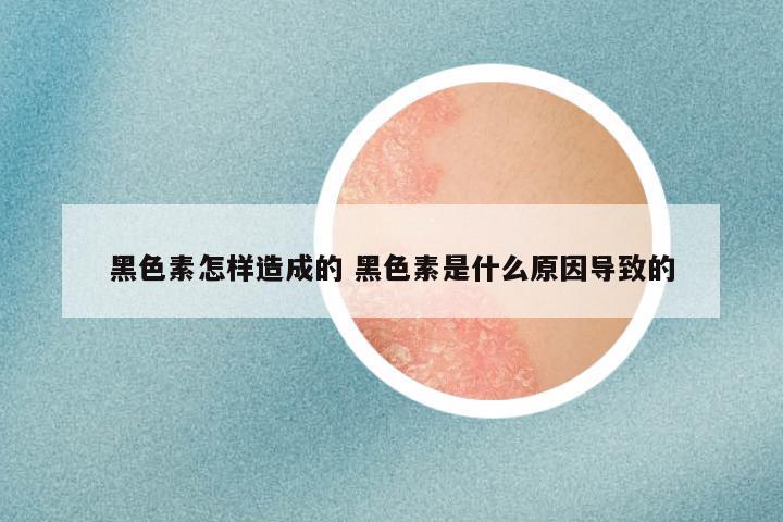 黑色素怎样造成的 黑色素是什么原因导致的