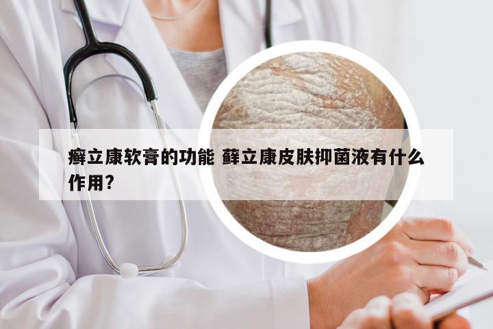 癣立康软膏的功能 藓立康皮肤抑菌液有什么作用?
