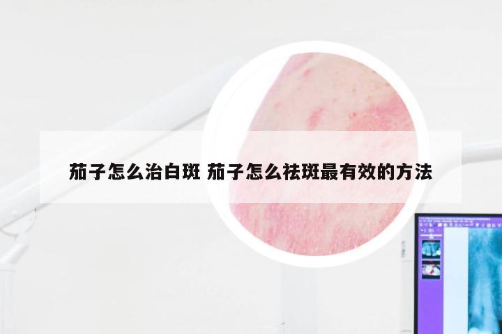 茄子怎么治白斑 茄子怎么祛斑最有效的方法