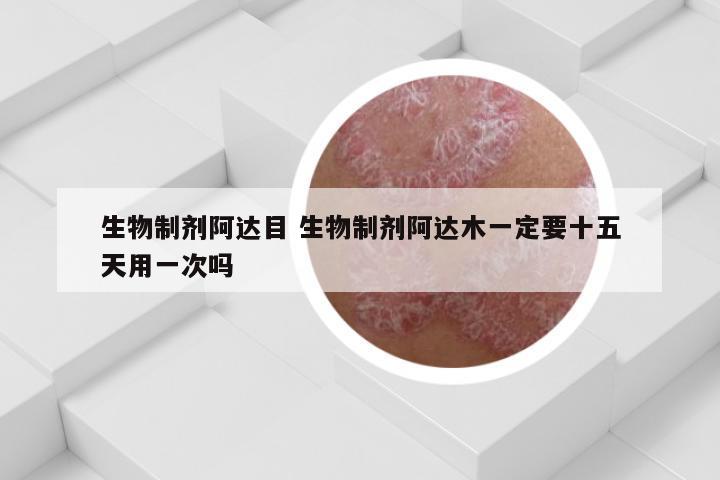 生物制剂阿达目 生物制剂阿达木一定要十五天用一次吗