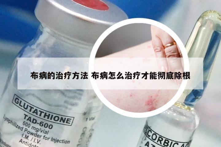 布病的治疗方法 布病怎么治疗才能彻底除根