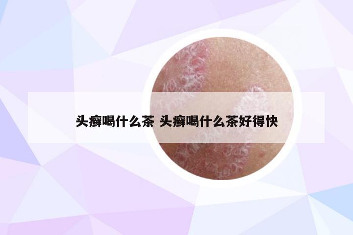 头癣喝什么茶 头癣喝什么茶好得快