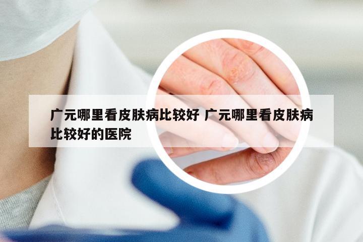 广元哪里看皮肤病比较好 广元哪里看皮肤病比较好的医院