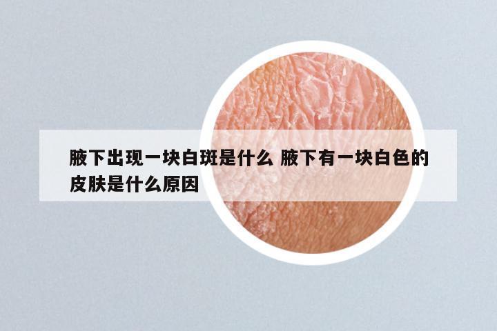 腋下出现一块白斑是什么 腋下有一块白色的皮肤是什么原因