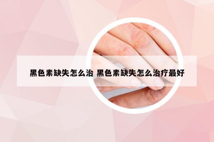 黑色素缺失怎么治 黑色素缺失怎么治疗最好