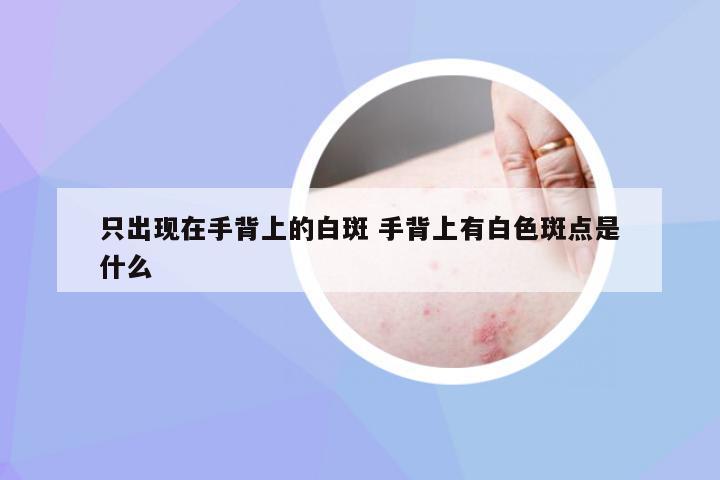 只出现在手背上的白斑 手背上有白色斑点是什么