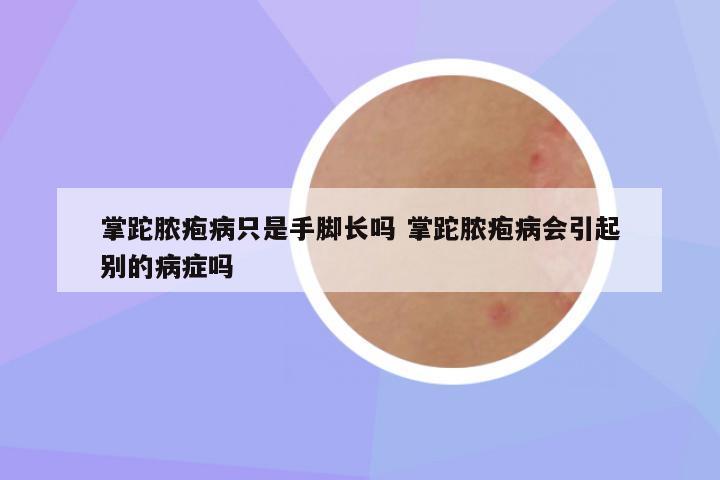 掌跎脓疱病只是手脚长吗 掌跎脓疱病会引起别的病症吗