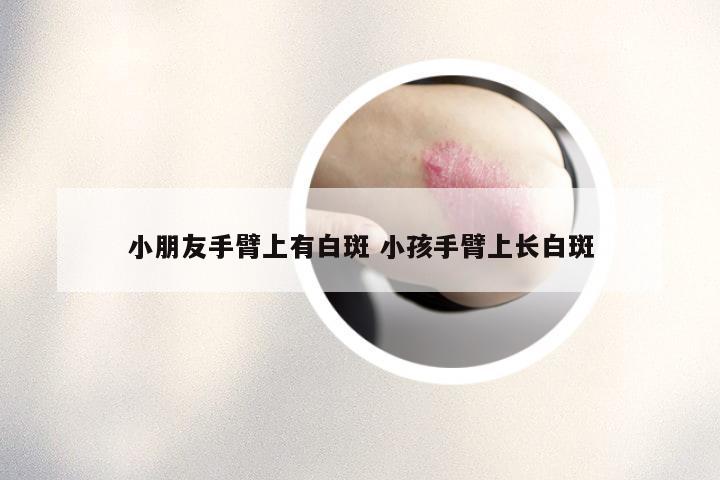 小朋友手臂上有白斑 小孩手臂上长白斑