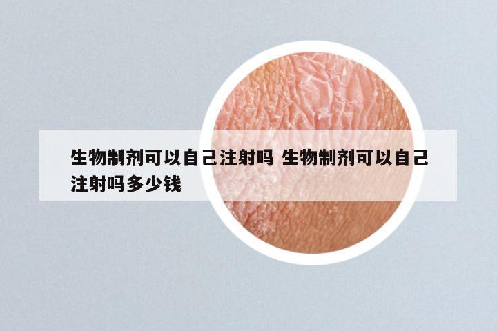生物制剂可以自己注射吗 生物制剂可以自己注射吗多少钱