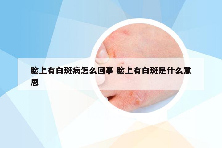 脸上有白斑病怎么回事 脸上有白斑是什么意思