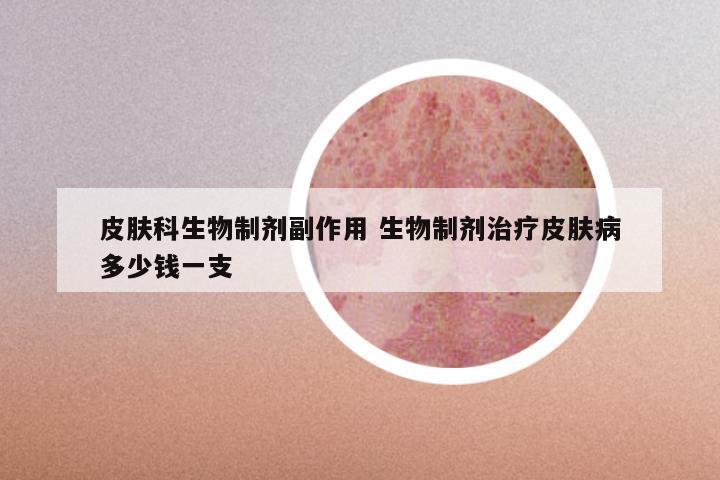 皮肤科生物制剂副作用 生物制剂治疗皮肤病多少钱一支