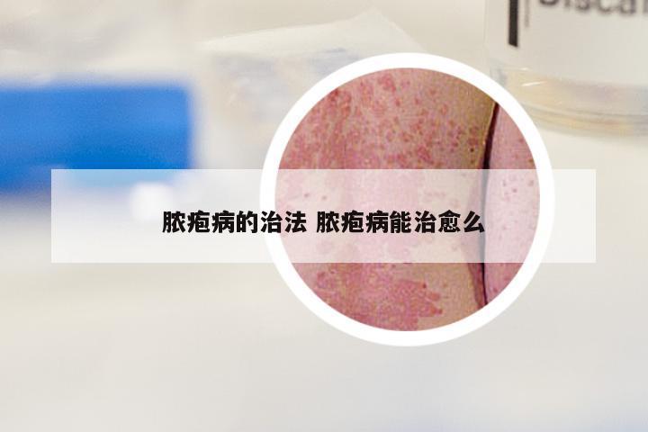 脓疱病的治法 脓疱病能治愈么