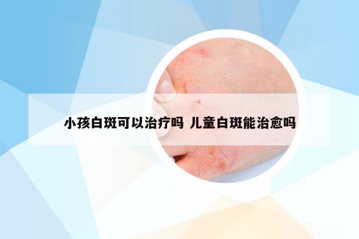 小孩白斑可以治疗吗 儿童白斑能治愈吗