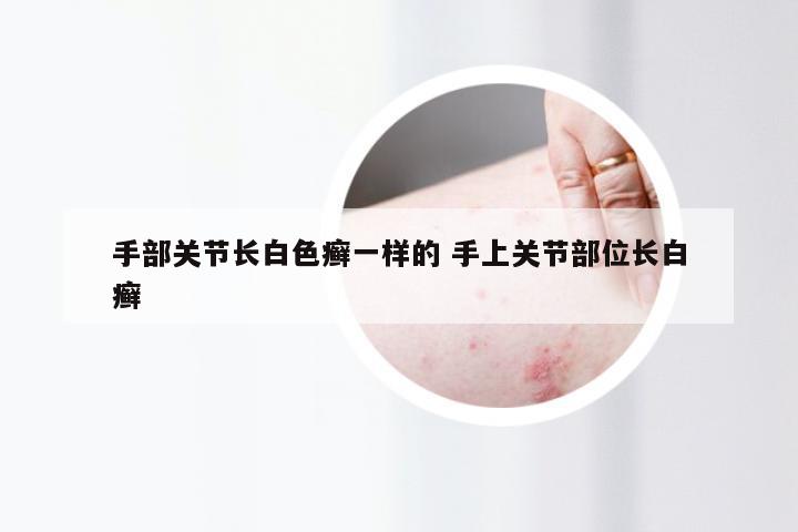 手部关节长白色癣一样的 手上关节部位长白癣