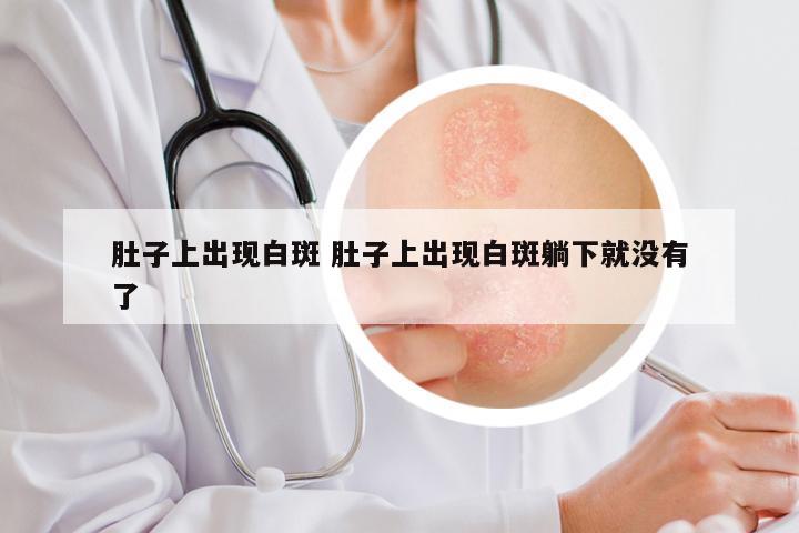 肚子上出现白斑 肚子上出现白斑躺下就没有了