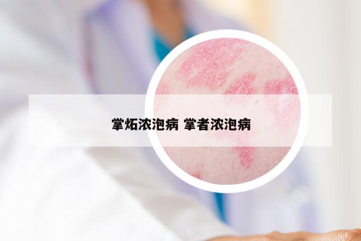 掌炻浓泡病 掌者浓泡病
