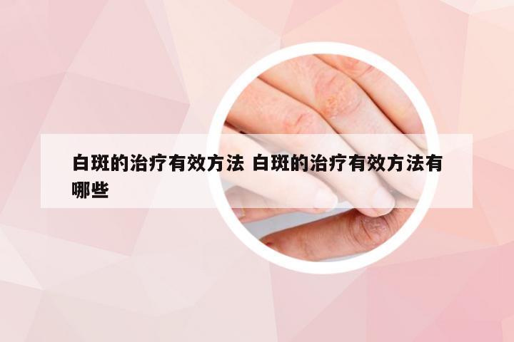 白斑的治疗有效方法 白斑的治疗有效方法有哪些