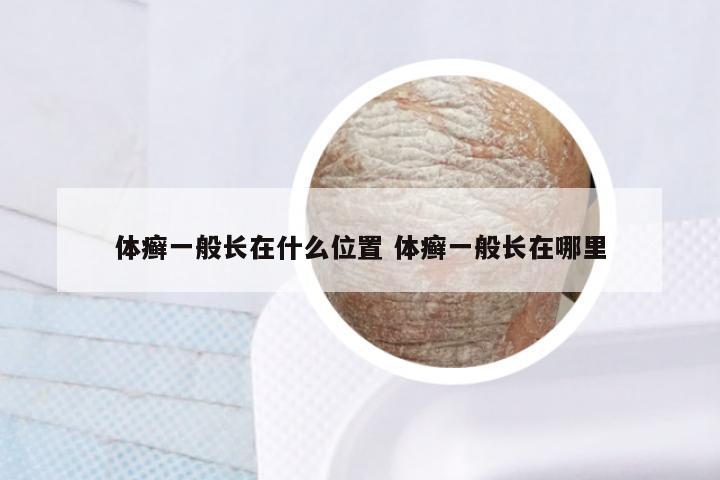 体癣一般长在什么位置 体癣一般长在哪里