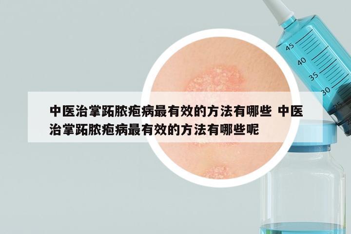 中医治掌跖脓疱病最有效的方法有哪些 中医治掌跖脓疱病最有效的方法有哪些呢