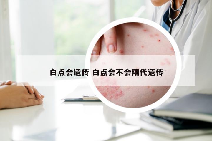 白点会遗传 白点会不会隔代遗传