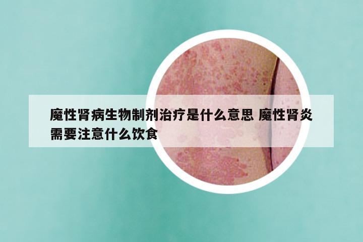 魔性肾病生物制剂治疗是什么意思 魔性肾炎需要注意什么饮食