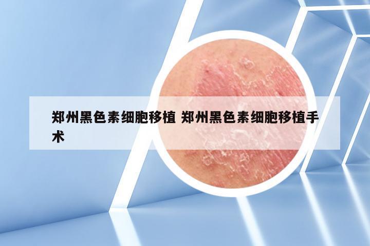 郑州黑色素细胞移植 郑州黑色素细胞移植手术