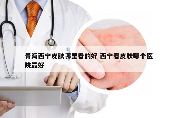青海西宁皮肤哪里看的好 西宁看皮肤哪个医院最好