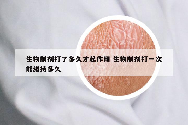 生物制剂打了多久才起作用 生物制剂打一次能维持多久
