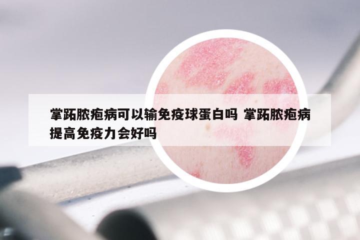掌跖脓疱病可以输免疫球蛋白吗 掌跖脓疱病提高免疫力会好吗