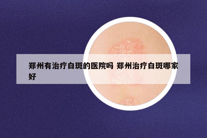 郑州有治疗白斑的医院吗 郑州治疗白斑哪家好