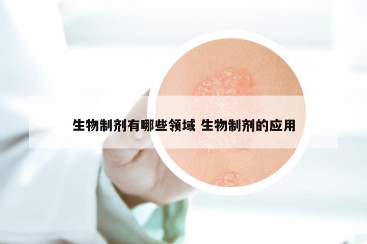 生物制剂有哪些领域 生物制剂的应用