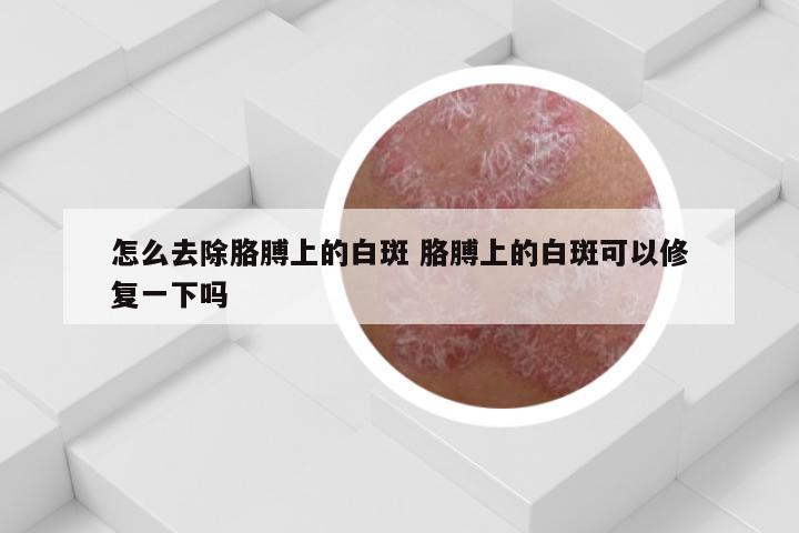 怎么去除胳膊上的白斑 胳膊上的白斑可以修复一下吗