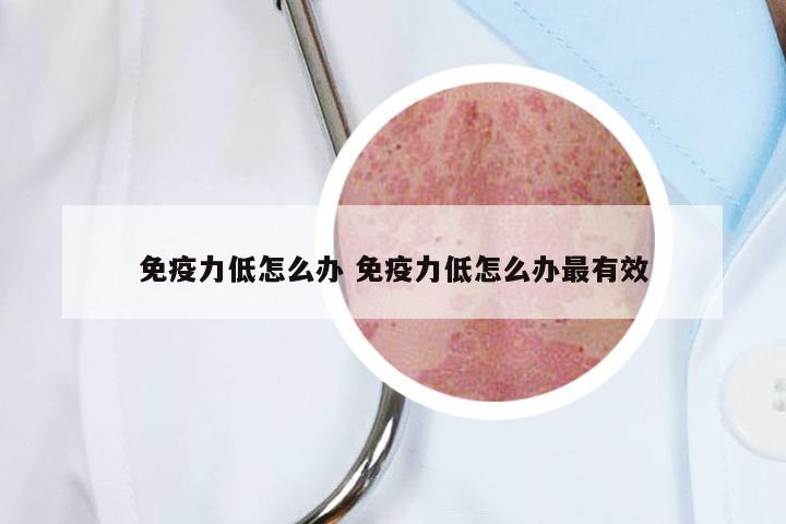 免疫力低怎么办 免疫力低怎么办最有效