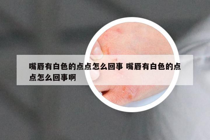 嘴唇有白色的点点怎么回事 嘴唇有白色的点点怎么回事啊