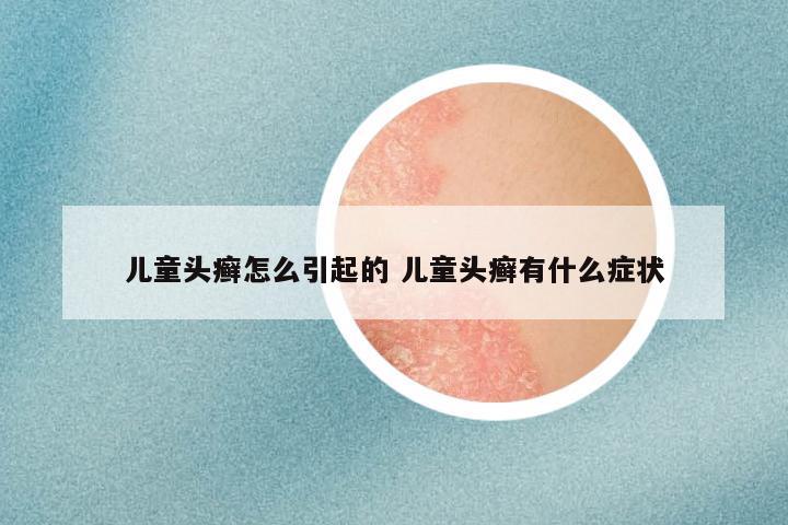 儿童头癣怎么引起的 儿童头癣有什么症状