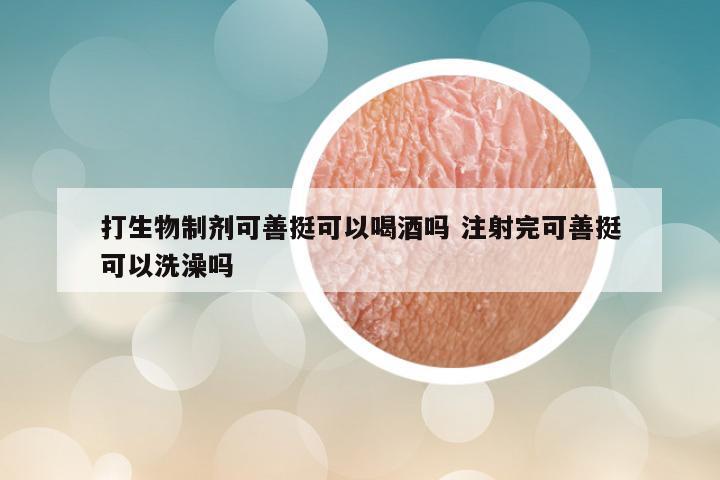 打生物制剂可善挺可以喝酒吗 注射完可善挺可以洗澡吗