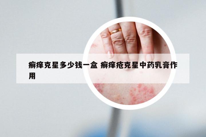 癣痒克星多少钱一盒 癣痒疮克星中药乳膏作用