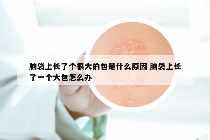脑袋上长了个很大的包是什么原因 脑袋上长了一个大包怎么办