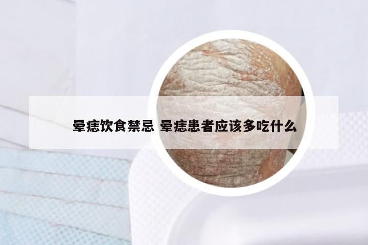 晕痣饮食禁忌 晕痣患者应该多吃什么