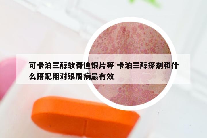 可卡泊三醇软膏迪银片等 卡泊三醇搽剂和什么搭配用对银屑病最有效