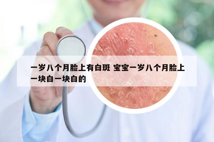 一岁八个月脸上有白斑 宝宝一岁八个月脸上一块白一块白的
