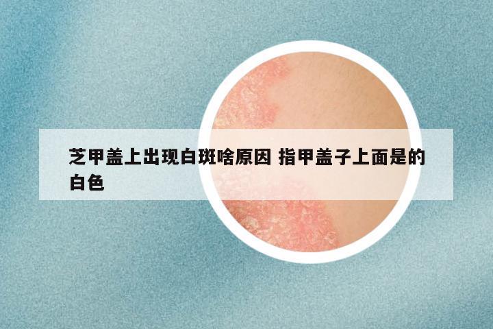 芝甲盖上出现白斑啥原因 指甲盖子上面是的白色