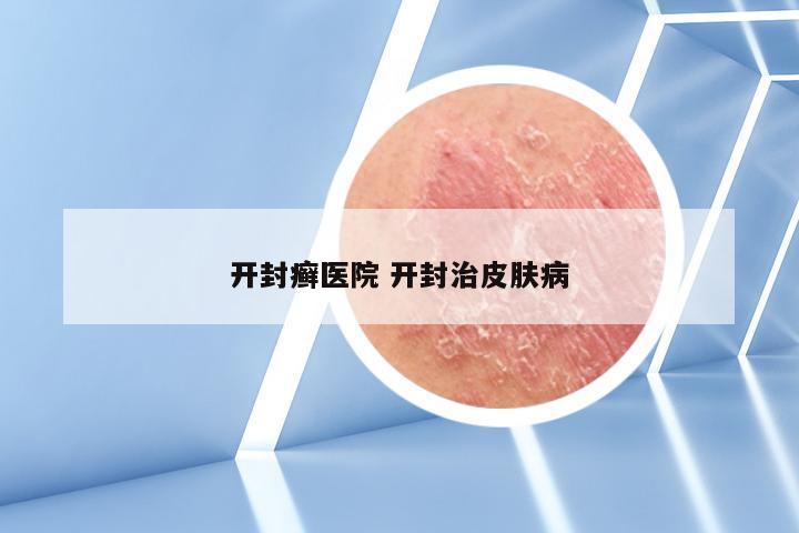 开封癣医院 开封治皮肤病